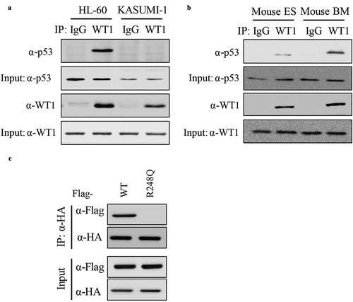 Figure 2. P53 directly binds to WT1. (a) Endogenous WT1 protein was immunoprecipitated from two human AML cell lines (i.e. HL-60 and KASUMI-1), followed by western blot to detect p53. Normal rabbit IgG was used as a negative control; (b) Endogenous WT1 protein was immunoprecipitated from mouse ESCs or BMCs cells, followed by western blot to detect p53. Normal rabbit IgG was used as a negative control; (c) Wild-type p53 and p53R248Q were co-expressed with WT1 in HEK293T cells. Protein–protein interaction was examined by IP-western using the indicated antibodies