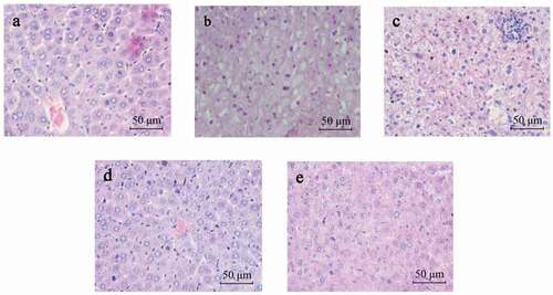 Figure 1. Representative photomicrographs of mice’s hepatic tissue (H&E staining; Scale bar, 50 μm). (a) NC group; (b) MC group; (c) Y61 group; (d) Y15 group; and (e) PC group.Figura 1. Fotomicrografías representativas del tejido hepático de los ratones (tinción de H&E; barra de escala, 50 μm). (a) Grupo NC; (b) Grupo MC; (c) Grupo Y61; (d) Grupo Y15; y (e) Grupo PC