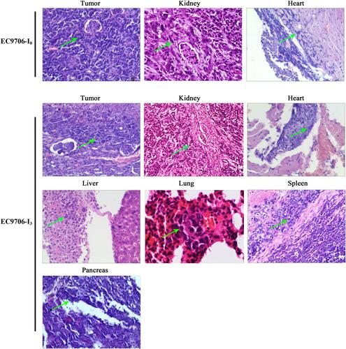 Figure 5 Tumor cells metastasis in the EC9706 xenograft subrenal capsule model visualized by hematoxylin and eosin staining. Green arrow, tumor cells metastasized to other organs.