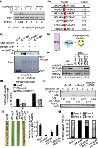 Figure 6. MoHat1 acetylates MoAtg9 to regulate autophagy and pathogenicity. (a) Acetylation of GFP-MoAtg9 protein in Guy11 and ∆Mohat1 mutant. GFP-MoAtg9 in Guy11, ∆Mohat1 mutant and ∆Moatg9/MoATG9K621R (K621R) strains were starved for 0 or 2 h. Proteins were immunoprecipitated with the antibody to acetylated-lysine followed by immunoblotting with the antibody to GFP. (b) Prediction of acetylation sites of MoAtg9. Bioinformatics forecast through a prediction website PAIL (Prediction of Acetylation on Internal Lysines) (http://bdmpail.biocuckoo.org/prediction.php) found 7 potential acetylation sites. (c) In vitro acetylation of MoAtg9. Purified GST, GST-MoAtg9 WT (GST-WT), GST-MoAtg9K621R (GST-K621R) proteins were measured by means of immunoprecipitation with antibody to acetylated-lysine followed by immunoblotting with GST antibody. (d) Diagrammatic sketch of MoAtg9 function in autophagy regulation. The Golgi apparatus is one of the origins for the autophagosomal membrane and Atg9-containing membrane from the Golgi apparatus is important for increasing the AP number. (e) The binding ability of MoAtg9 to membrane structures. Under CM or MM-N conditions, vesicle protein of Guy11 (WT), ∆Mohat1, ∆Moatg9/MoATG9K621R (K621R) and the complemented strain ∆Moatg9/MoATG9 expressing MoSft2-RFP were extracted using ultracentrifugation and detected with antibodies to GFP and RFP. MoSft2 was used as a Golgi apparatus marker. (f and g) Acetylation of MoAtg9 is important for autophagy. Autophagy levels in Guy11, ∆Moatg9 and ∆Moatg9/MoATG9K621R (K621R) mutant strains under starvation were analyzed by means of western blot for (F) GFP-MoAtg8 cleavage and (g) translocation of GFP-MoAtg8 into vacuoles (n = 100). Bars with asterisks represent significant differences (Duncan’s new multiple range method p < 0.01). (h) Rice spraying assays. Four milliliters of conidial suspension (5 × 104 spores/ml) of each strain was used for spraying and photographed 7 days after inoculation. (i) Total DNA was extracted from per 1.5 g disease leaves from (h) and test by qRT-PCR with M. oryzae 28S rDNA and rice genomic RUBQ1 primers. Asterisks indicate statistically significant differences (Duncan’s new multiple range test, p < 0.01). (j) Detailed statistical analysis for infectious growth in rice sheath cells at 24 hpi. Appressorium penetration sites (n = 100) were observed and invasive hyphae were rated from type 1 to 4. Error bars represent SD from 3 independent experiments.