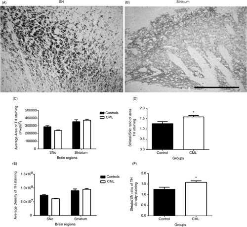 Fig. 2 Changes in TH staining in the SNc and the striatum. Representative images showing TH (×20) staining in the A9 region of the SNc (A) and in the striatum (B) of rats. The average area of TH staining in the SNc and the striatum (C), the striatum/SNc ratio of the area of TH staining (D), the average density of TH staining in the SNc and the striatum (E), and the striatum/SNc ratio of the density of TH staining (F) of control (closed bars, n=15–16) and CML-supplemented (open bars, n=15–16) rats are shown. Data are presented as mean±SEM, *p<0.05, scale bar=100 µm.