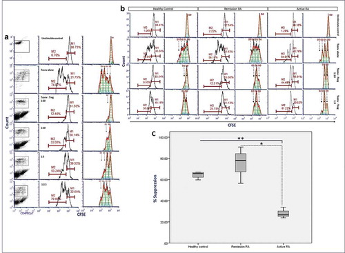 Figure 4. Co-culture suppression assay with short-term regulatory T cells (Treg) expansion and IL-2-pre-cultured autologous T cells (Tconvs) from healthy donors and patients with active rheumatoid arthritis (RA) and patients in remission which classified by ACR/EULAR 2010 or ACR 1987 criteria. IL-2-pre-cultured Tconv (1x104 cells) were co-cultured with short-term expanded Tregs in culture medium supplemented with 500 IU/mL of human recombinant IL-2 and anti-CD3/28 beads for 72 h at 37ºC under an atmosphere of 5% CO2. Following co-culture, Tconvs were labeled with carboxyfluorescein succinimidyl ester (CSFE), counted in a Beckman Colter-FC500 and analyzed by FCS Express v.4. (a) Percent Tconv at different ratios of Tconv:Treg from a healthy donor. Left, center and right column: dot plot, histogram and histogram curve analysis, respectively, of CFSE-labeled Tconvs. (b) Percent Tconv at different ratios of Tconv:Treg from a healthy donor, a patient with active RA and an RA patient in remission donor. Left and right panel of each donor type: histogram and histogram curve analysis, respectively, of CFSE-labeled Tconvs. (c) Plot of percent suppression (in Tconvs:Treg ratio as 1:10) of healthy control donors (n = 4), patients with active RA (n = 3) and RA patients in remission (n = 3). Horizontal line, vertical line, and box represent group of patients and healthy control, percent suppression of Treg, box-plot with mean and range of the percent suppression, respectively. M1, original cell population; M2, proliferated cell population; D0, original cell division; D1, the first cell division; D2, the second cell division; D3, the third cell division; *p-value = 0.011, **p-value <0.0001; independent sample t-test.