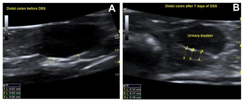 Figure 2 A sonographic view of the distal colon in rat showing distal colon before dextran sodium sulfate (DSS) intake (A) and wall thickening after 7 days of DSS intake (B).