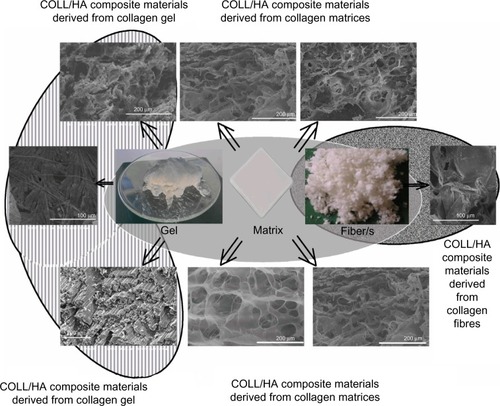 Figure 1 Collagen (COLL) forms and their COLL/hydroxyapatite (HA) composite (nano)materials.Notes: Reprinted from Chem Eng J.160. Ficai A, Andronescu E, Voicu G, et al. Self assembled collagen/hydroxyapatite composite materials. 794–800. Copyright (2010), with permission from Elsevier.Citation12 Reprinted from Mater Lett. 64. Ficai A, Andronescu E, Trandafir V, Ghitulica C, Voicu G. Collagen/hydroxyapatite composite obtained by electric field orientation. 541–544. Copyright (2010), with permission from Elsevier.Citation21 Adapted from Golub LM. Special Issue: Clinical Applications of Non-Antbacterial Tetracyclines Introduction. Pharmacol Res. 2011;63:99–101.Citation114