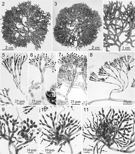 Figs 2–11. Neoizziella asiatica, sp. nov. 2. Holotype, a female plant. 3. Habit, a liquid preserved, female plant. 4. Close-up of a female plant showing branching pattern and cystocarps (arrows). 5. Young cortex showing spermatangial initials. 6. Differentiating spermatangia (arrowheads) and the discharged spermatangia (white arrows). 7. Mature spermatangia (arrowheads) in cluster. 8. Close-up of assimilatory filaments and carpogonial branches (arrows). 9. An early post-fertilization stage showing supporting cell (sc), carpogonial branch (cb), fertilized carpogonium (ca), gonimoblast initial (gi) and initials of involucral filaments (arrows). 10. Another post-fertilization stage showing supporting cell (sc), carpogonial branch (cb), fertilized carpogonium (ca), early gonimoblasts (g) and branched involucral filaments (arrows). 11. A later post-fertilization stage showing supporting cell (sc), elongated carpogonium (ca), developing gonimoblasts (arrowheads) and elongated involucral filaments (arrows).