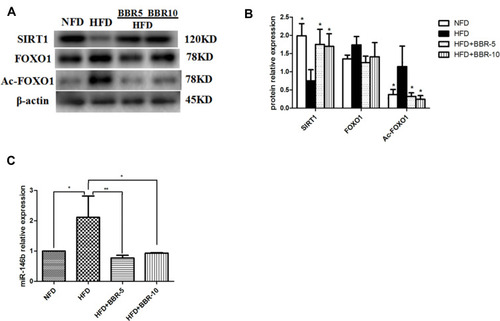 Figure 3 (A and B) Total proteins of liver tissues were extracted and subjected to Western blot analysis for the detection of SIRT1, FOXO1, Ac-FOXO1. Representative images are shown (left). For quantification, optical densities of the bands were determined. (C) miR-146b expression in different groups. *p<0.05; **p<0.01. Data are expressed as the means±SEM of at least three independent experiments.