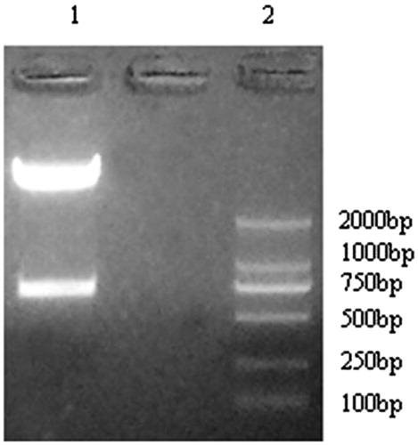 Figure 2. pYr-1.1 plasmid digest with BASI enzyme. Lane 1: pYr-1.1 plasmid; Lane 2 Marker.