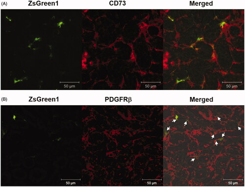 Figure 4. Identification of transgene-expressing cells by immunostaining of markers for peritubular fibroblasts and pericytes. (A and B) The right kidney was suctioned at −30 kPa after i.v. injection of pZsGreen1-N1. The kidney was collected at 24 h after transfection, and 10 μm-thick frozen sections were stained with anti-CD73 and -PDGFRβ antibodies. The stained sections were observed by CLSM. Magnification: ×40. Red: CD73-positive peritubular fibroblasts (A) and PDGFRβ-positive pericytes (B); green: ZsGreen1. White arrows (B) show ZsGreen1 merged with PDGFR-β-positive pericytes. All scale bars represent 50 μm. Color version of this figure is available Online.