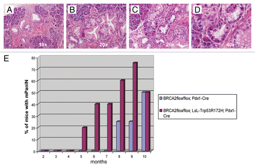 Figure 3 Histopathology of non-invasive precursor lesions in CB mice. Examples of low-grade (A) and high-grade (B) mPanIN lesions arising in the pancreas of a CB mouse at 11 months of age. Several areas with acinar-to-ductal metaplasia were also found (C); higher magnification (D). (H&E stains). (E) CBP mice (red columns) have an earlier onset of mPanIN compared to CB mice (blue columns). By 10 months of age, both cohorts have comparable frequency of mPanIN lesions.