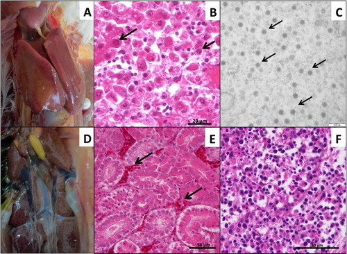 Figure 5. Pathogenicity in SPF chickens. (A) Severe hydropericardium and swollen and friable liver with multifocal areas of necrosis. (B) Basophilic intranuclear inclusion bodies in liver cells (arrows, H&E stain). (C) Adenovirus virions in liver tissues (arrows). (D) Mild or severe enlargement of kidney of dead chickens. (E) Protein casts in renal tubules and extensive congestion in renal interstitium (arrows, H&E stain). (F) Large numbers of necrotic lymphocytes in lymph follicles in the bursa (H&E stain).