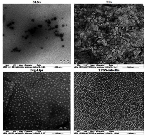 Figure 1 Transmission electron microscope images of the prepared lipid-based nanocarriers.