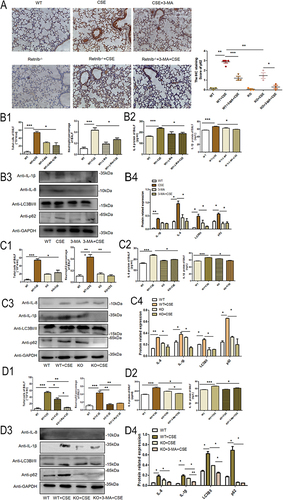 Figure 6 RELMβ promotes COPD airway inflammation in C57BL/6J mice via autophagy. (A), IHC verification of p62 expression in C57BL/6J mice. (B1), Mouse BALF total cell count and percentage of neutrophils in 3-MA pretreated C57BL/6J mice; (B2) Mouse BALF IL- 8 and IL-1βsecretion by ELISA in 3-MA pretreated C57BL/6J mice; (B3) The expression of IL-8, IL-1β and autophagy protein in mouse lung tissue; (B4) Densitometric analysis of the protein grayscale values. (C1), Mouse BALF total cell count and percentage of neutrophils in C57BL/6JRELMβ-/- mice; (C2) mouse BALF IL- 8 and IL-1βsecretion by ELISA in C57BL/6JRELMβ-/- mice; (C3) The expression of IL-8 and IL-1β and autophagy protein in C57BL/6JRELMβ-/- mice lung tissue; (C4) Densitometric analysis of the protein grayscale values. (D1), Mouse BALF total cell count and percentage of neutrophils in 3-MA pretreated C57BL/6J RELMβ-/- mice; (D2) Mouse BALF IL- 8 and IL-1βsecretion by ELISA in 3-MA pretreated C57BL/6J RELMβ-/- mice; (D3) The expression of IL-8 and IL-1β and autophagy protein in 3-MA pretreated C57BL/6J RELMβ-/- mice; (D4) Densitometric analysis of the protein grayscale values. (*p < 0.05, **p < 0.01, ***p < 0.001).
