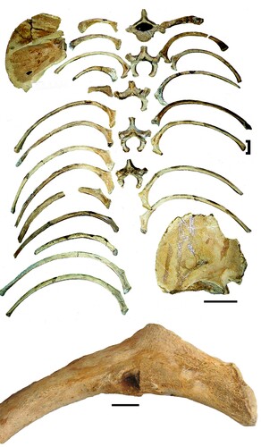 FIGURE 8. Composite sub-adult trunk assembly suggests that most of the ribs belonged to the subadult. The scale bar for the rib cage is 20 cm. The infant scapula is to the upper right, the sub-adult to the lower left. The enlargement of the remodeled puncture wound in rib SUI 102849L documents past trauma. The punctured rib is noted by a bracket. The scale bar on the latter is 10 mm.