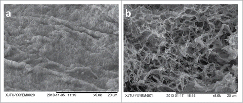 Figure 3. The spleen capsule (a) and the spleen extracellular matrix (b) of the DSM by SEM. Scale bars: 20μm.