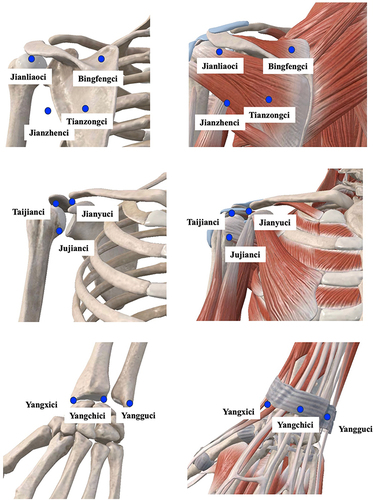 Figure 3 Locations of acupuncture points.