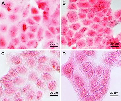 Figure 6 Intracellular uptake experiments. Prussian blue staining images of the Huh-7 cells after 12 h of incubation with (A) USPIO and (B) Apt-USPIO display the blue granules in the cytoplasm of Apt-USPIO-incubated Huh-7 cells, but no stain was found in the USPIO-incubated control cells. No specific stain was found in the L-02 cells incubated with (C) USPIO and (D) Apt-USPIO.Abbreviations: Apt-USPIO, aptamer-mediated USPIO; USPIO, ultrasmall superparamagnetic iron oxide.