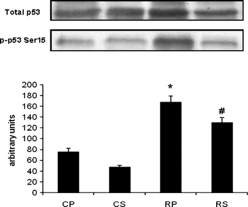 Figure 7  The effect of restraint and Sutherlandia supplementation on p53 phosphorylation in gastocnemius muscle. Samples were analysed by western blotting with antibodies recognizing phospho- and total p53. Results are expressed as means ± SEM for eight independent experiments, *p < 0.001 vs. CP; #p < 0.05 vs. RP, F = 41.36. CP, control placebo; CS, control Sutherlandia; RP, restraint placebo; RS, restraint Sutherlandia.
