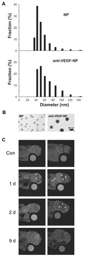 Figure 2 In vivo MRI of anti-VEGF-NPs or NPs injected into mice bearing colon tumors. (A) Particle size and distribution of NPs and anti-VEGF-NPs were determined by DLS method. (B) Representative TEM image of NPs and anti-VEGF-NPs; the particle sizes ranged between 15–30 and 45–65 nm, respectively. Scale bar = 50 nm. (C) In vivo MRI of mice bearing colon tumors at the indicated time points (1 d, 2 d, and 9 d) after intravenous injection of 10 mg Fe/Kg of NPs (left panels) or anti-VEGF-NPs (right panels).Notes: The same mice before injection of anti-VEGF-NPs or NPs were used as controls. The dashed lines and arrows indicate the location of the colon tumor and the location of the nanoparticles, respectively.Abbreviations: MRI, magnetic resonance imaging; VEGNF-NPs, vascular endothelial growth factor nanoparticles; NPs, nanoparticles; DLS, dynamic light scattering; TEM, transmission electron microscopy; d, day.