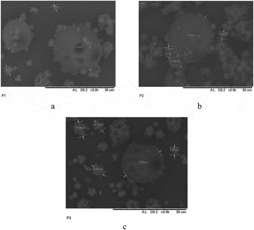 Figure 8. Microcapsule morphology as seen in the scanning electron microscope: (a) 5 ml of propolis, (b) 10 ml of propolis, (c) 15 ml of propolis. The accelerating voltages used in SEM image analysis of biological material vary between 5 and 20 kV.