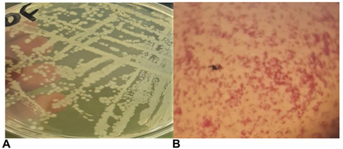 Figure 7 Culture positive plates, grossly, white to pale pinpoint cells arranged in chain (A). Microscopic view of gram-negative colonies with pink color and short ovoid rods in shape (B).