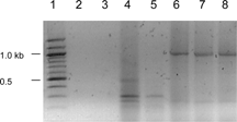 Figure 5 RT-PCR assay results for iNOS gene expression in the rat thoracic aortic rings. Lane 1: Molecular weight marker (New England Bio Labs, 100 bp DNA ladder); Lanes 2–3: RT-PCR products from 2 normal rat aorta samples. Absence of a 278 bp band indicates lack of iNOS gene expression; Lanes 4–5: Rat iNOS cDNA band (278 bps; positive controls); Lanes 6–8: Glycerol aldehyde-3-phosphate dehydrogenase (GAPDH) cDNA (983 bps; control gene expression).