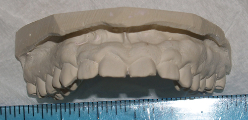 Figure 3. Dental model from Ken Phillips