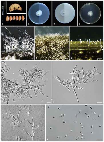 Figure 2. Heteroverticillium phytelephatis (CGMCC3.23995, ex-type culture). a: Disease symptoms on host plant. b: Front and reverse colony on PDA (7 d). c: Front and reverse colony on OA (7 d). d: Front and reverse colony on MEA (7 d). e–g: Aerial conidiophores. h–j: Conidiophores and phialides. k: Conidia. Scale bars: e–g = 50 μm; h–k = 10 μm.