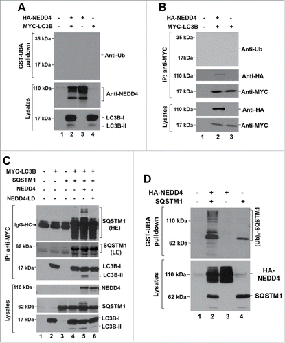 Figure 8. SQSTM1, but not LC3, is a ubiquitination substrate of NEDD4. (A) and (B), NEDD4 and Myc-tagged LC3B were coexpressed in HEK293 cells. Ubiquitinated proteins were precipitated by GST-UBA and immunoblotted with an anti-LC3 (in (A)), or Myc-tagged LC3B was immunoprecipitated by anti-MYC antibody and immunoblotted with an anti-ubiquitin antibody (B). (C) SQSTM1 was coexpressed with NEDD4 or its ligase-dead mutant NEDD4C867A (NEDD4-LD) and Myc-tagged LC3B in HEK293 cells. LC3B was immunoprecipitated with anti-MYC, and the coimmunoprecipitated SQSTM1 was detected with an anti-SQSTM1 antibody. HE, high exposure; LE, low exposure. The shifted SQSTM1 bands are framed by a white line. (D) SQSTM1 was coexpressed with HA-NEDD4 in HEK293 cells. Ubiquitinated proteins were precipitated by GST-UBA and immunoblotted with an anti-SQSTM1.