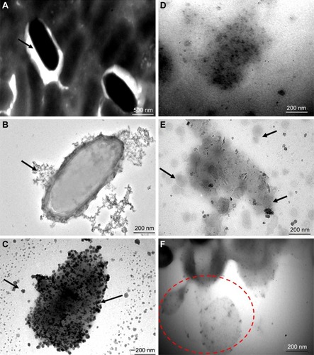 Figure 5 Results of a TEM study on the morphological assessment when treated with optimization placebo nanoemulsions comprised of labrasol and capmul MCM C8 in comparison with untreated tubercular bacilli (Mycobacterium tuberculosis H37 Rv). These representative images portrayed sequential events after 30 minutes of treatment with explored nanoemulsions, suggesting a possible mechanistic view of action against a tubercular strain. (A) Normal intact smooth margin of tubercular bacilli, (B and C) progressive damage of a bacterial cell wall followed by fragmentation (black arrows), (D) loss of integrity of bacterial cell wall, (E) mechanistic view of nanoemulsion action after adherence around the bacterial cell surface (nano globules around the surface), and (F) oozing out of the cytoplasmic content of bacterium after nanoemulsion mediated cell wall damage.Abbreviation: TEM, transmission electron microscopy.