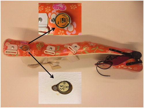 Figure 1. The temperature sensor-data-logger attached to the KAFO. The KAFO as shown in the figure is configured with a fixed knee angle and a variable ankle angle using a spring that provides variable ankle dorsiflexion. The temperature sensor-data-logger was attached to the KAFO with a nut (upper inset) and bolt (lower inset). The flat side (lower inset) of the sensor-data-logger touched the participants skin while wearing the KAFO.