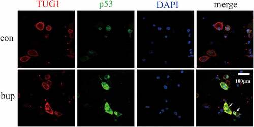 Figure 7. P53 and TUG1 share a common expression site. Blue fluorescence site is DAPI stained cell nucleus; red fluorescence is the lncRNA TUG1 expression site labeled in the FISH partial experiment; green fluorescence is the p53 protein expression site stained.