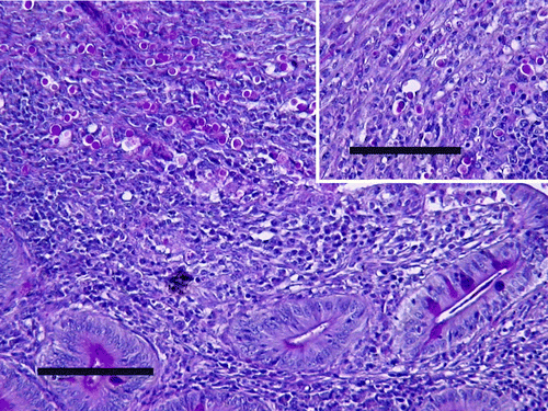 Figure 2.  Histologic section of turkey caeca, died 11 days p.i. with H. meleagridis. Note large histomonad invasion within the mucosa. Periodic acid Schiff reagent (PAS), bar = 100 µm. Inset: histomonads up to the muscular layer. PAS, bar = 100 µm.