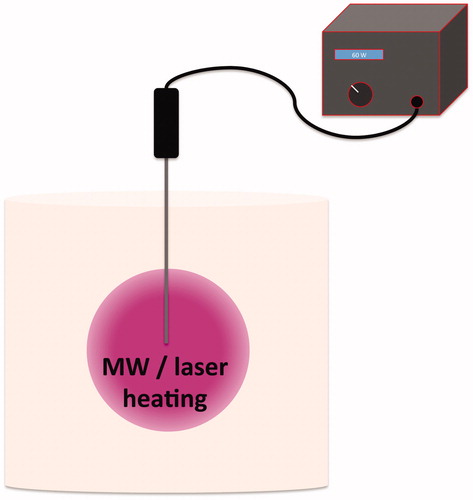 Figure 2. Schematic of the experiment set-up for laser and microwave heating of the tissue-mimicking thermochromic (TMTC) phantom. The thermal therapy applicator (microwave or laser) was advanced to the centre of a TMTC phantom, and the therapy device was operated with fixed parameters: 60 W and 10 min for microwave, and 15 W and 90 s for laser.