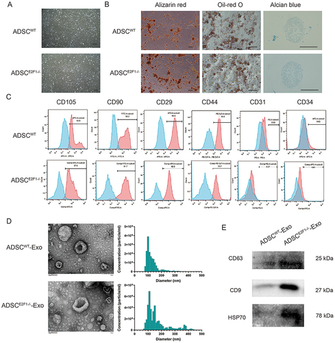 Figure 1 Characterization of ADSCs and exosomes. (A) Morphology of ADSCs isolated from WT and E2F1–/– C57BL/6 mice. Bar = 200 µm. (B) Alizarin red staining, Oil-red O staining, and Alcian blue staining of ADSCs after tri-lineage differentiation induction. Bar = 200 µm. (C) Flow cytometry detected the MSC markers CD44, CD90, CD105, and CD29, as well as hematopoietic lineage markers CD31 and CD34. (D) Morphology of exosomes observed under the transmission electron microscope (TEM), and the particle size distribution of exosomes. (E) The exosome surface markers CD63, CD9, and HSP70 were detected by Western blot.