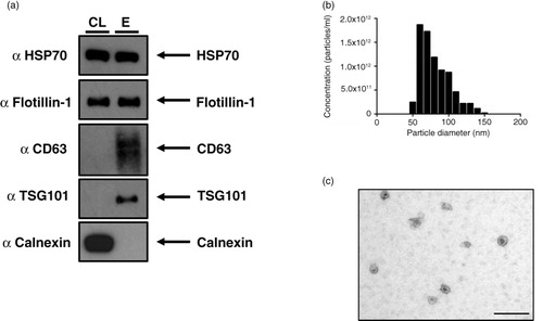 Fig. 1.  The NSCLC SK-MES-1 cell line produces exosomes that can be isolated with ultrafiltration of CCM. (a) 5 µg of protein was used for Western blot analysis of isolated exosomes. The presence of canonical exosome proteins, and the absence of Calnexin demonstrates a pure exosome preparation. (b) TRPS analysis demonstrates a size distribution of particles consistent with the size range of exosomes. (c) EM image of exosomes demonstrates cup-shape morphology, size bar=200 nm. CL: cell lysate; E: exosome lysate.