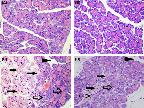Figure 1. Representative images of histological examination of pancreas in each group at 12 h were shown by hematoxylin and eosin staining (original magnification × 100). There were no remarkable pancreatic injury pathological changes in the control group (A) and the BML-111 control group (B). The broad necrosis of acinar (closed arrows), inflammatory cell infiltrates (open arrows), and interstitial edema (arrowheads) were observed in APALI group (C). The slight local necrosis, inflammatory cell infiltrates, and interstitial edema were only observed in the BML-111-pretreatment group (D).