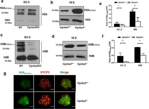 Figure 2. Ggnbp2 deletion leads to the up-regulation of H2AK119ubi and the down-regulation of H2BK120ubi.