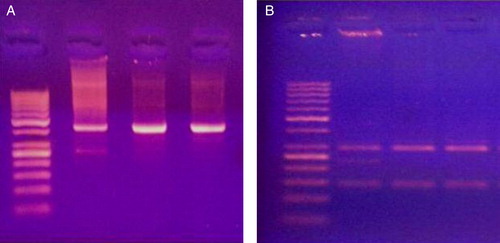 Figure 2. PCR products (A) and digestion products (B) for XPD Lys751Gln polymorphism of 3 cases. The first lane to the left is DNA ladder (50–1000 base). Lane 2 represents AC genotype. Lanes 3 and 4 represent AA genotype.