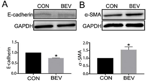 Figure 1 BEV caused epithelial-mesenchymal transition in human retinal pigment epithelial line cells. Western blot analysis showed BEV decreased the expression of E-cadherin (A) and increased the expression of α-SMA (B) significantly after exposed to BEV for 48 hours. *P< 0.05.