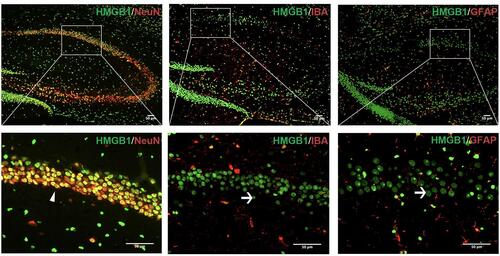 Figure 7 Predominant neuronal expression and release of HMGB1 in the hippocampus. Colocalization of HMGB1 with NeuN, IBA, and GFAP. The co-localization is in yellow in the image. The arrowhead indicates double-labelled cells, the arrow shows the HMGB1, which is not colocalized with the cell. The magnified images of the regions are marked with boxes. Scale bar = 100 mm.