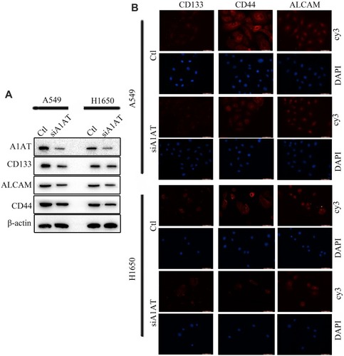 Figure 5 A1AT silencing inhibits stemness in NSCLC. (A, B) Analysis of CD133, ALCAM and CD44 expression by Western blotting (A) and immunofluorescence (B) in A1AT-silenced or control (Ctl) A549 and H1650 cells (scale bar, 50 μm). Si#03 indicates the siRNA used for the RNA interference.