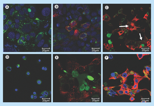 Figure 5.  Uptake of siRNA into PAM212 keratinocytes in control preparations.Conditions for transfection are identical to those described in Figure 2. (A) no treatment, 24 h; (B) free siRNA, 24 h; (C) G-IsoM/IsoS 30:70-siRNA, 24 h (arrows indicate uptake into the nuclei); (D) free 12–3–12 gemini surfactant, 24 h; (E) siRNA in 0.1% (w/v) 12–3–12 gemini surfactant solution, 1 h; (F) siRNA in 0.1% (w/v) 12–3–12 gemini surfactant solution, 24 h.