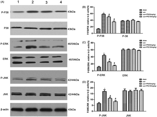 Figure 5. Effects of puerarin treatment in the expression of MAPK after UUO in mouse. (A) Representative Western blots gels for MAPK. Numbers 1, 2, 3, and 4 correspond to sham, UUO, UUO +50 mg/kg PR, and UUO +100 mg/kg PR groups, respectively. (B) Semiquantitative analysis of p38 and p-p38. (C) Semiquantitative analysis of ERK and p-ERK. (D) Semiquantitative analysis of JNK and p-JNK. p < .05 compared with the sham group; #p < .05 compared with the UUO group.