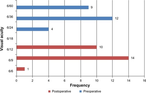 Figure 4 Comparison of pre- and postsurgical visual acuity among nondiabetic study participants (n = 25).