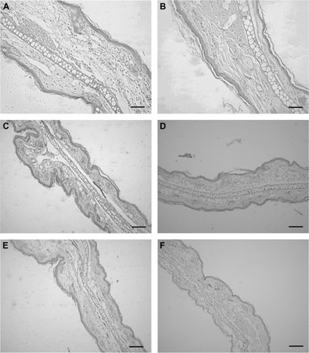 Figure 7 Photomicrographs of histological sections of the mouse ears (×10, hematoxylin and eosin-stained), evaluated 6 hours after induction of edema.Notes: Ears treated with (A) croton oil; (B) dexamethasone; (C) cream with extract; (D) nanoemulsion with extract; (E) cream without extract; and (F) nanoemulsion without extract. Scale bars =100 μm.