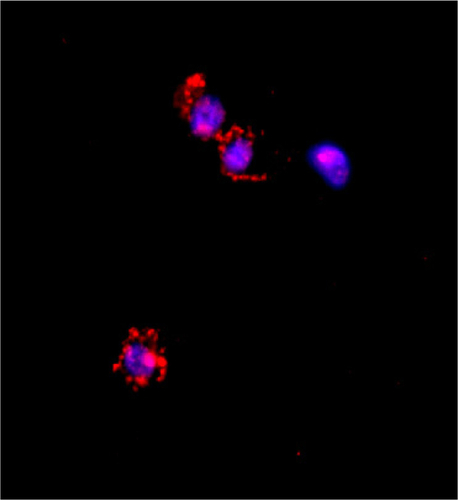 Figure S3 Confocal image of ThP1 cells showing rhodamine-labeled small poly-ε-caprolactone nanoparticles internalized by the cells after 6 hours of incubation.