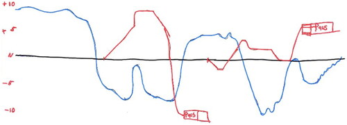 Figure 1. Example of a participant’s biographical map (Red = Sporting career; Blue = Mental health; N = timelines and neutral baseline. (Names of key markers removed to maintain anonymity).