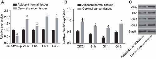 Figure 2. The RT-qPCR and western blotting show decreased miR-129-5p, increased ZIC2, and activated Hedgehog signaling pathway in CC tissues.Note: A, expression of miR-129-5p and mRNA expression of Shh, Gli1 and Gli2 using RT-qPCR; B, relative protein expression of ZIC2, Shh, Gli1 and Gli2 using western blotting; (c), protein bands of ZIC2, Shh, Gli1 and Gli2; miR-129-5p, microRNA-129-5p; CC, cervical cancer; ZIC2, zinc finger protein of the cerebellum 2; Shh, sonic Hedgehog; Gli, glioma-associated oncogene family zinc finger; RT-qPCR, reverse transcription-quantitative polymerase chain reaction; *, p < 0.05 compared with the adjacent normal tissues.