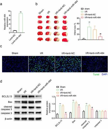 Figure 5. Overexpression of miR-484 alleviated cerebral ischemia/reperfusion injury in mice. (a) qPCR was applied to determine miR-484 expression level for each group, including lentiviral miR-484 and lentiviral NC vectors group. (b) Cerebral infarction volume was assessed to check protective effect of miR-484 on cerebral ischemia/reperfusion injury for each group. (c) Tunel assay was applied to determine cell apoptosis for each group. (d) Western blot was applied to detect cell apoptosis-related proteins for each group. **p < 0.01 versus sham-operated group and ##p < 0.01 versus lentiviral NC group