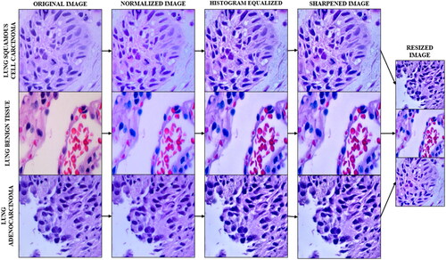 Figure 3. Image data pre-processing pipeline. Note: Resized images not reduced to scale.